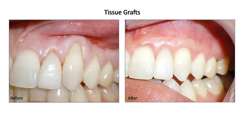cosmetic dentistry woodland hills